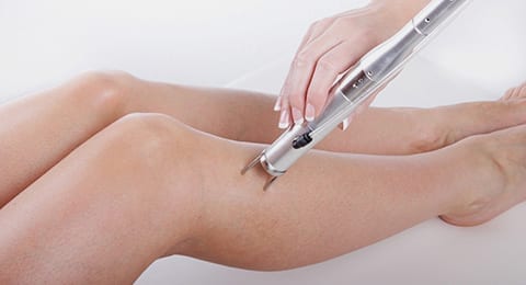 Laser Hair Removal - Skin Treatment Clinic in Huddersfield, Leeds and  Manchester - Skyn Doctor