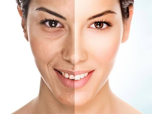 Hyperpigmentation Services in Rotherham